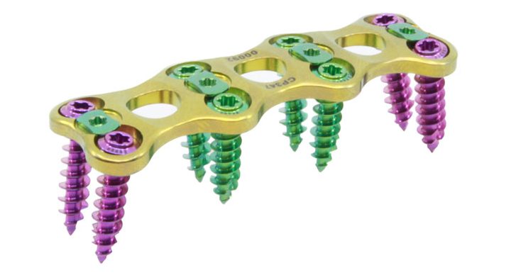Isometric View of a Slim, Sturdy Cervical Plate with screws