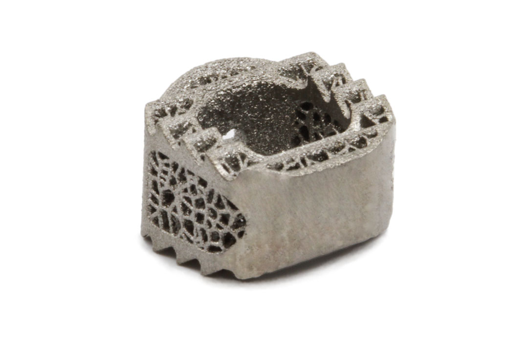3D Printed Titanium Cervical Cage
