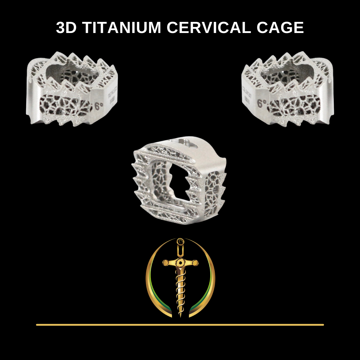 3D Printed Cervical Stand Alone Cage