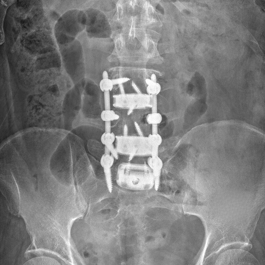 Spine Scan 5