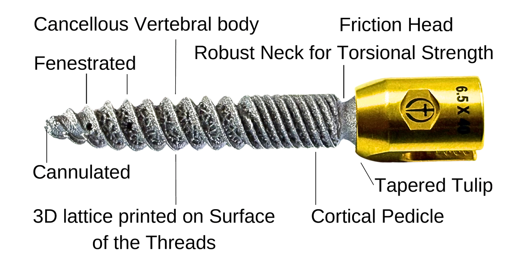 3d Printed Pedicle Screw Features Diagram