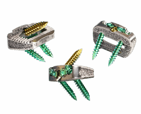 Alif Stand Alone 3d Titanium Heading Image