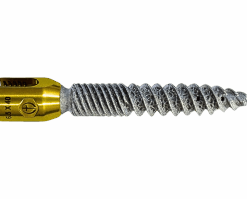 Revised Screw